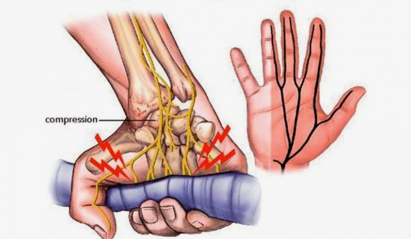 prostatitis y hormigueo en los pies prostatitis y hormigueo en los pies